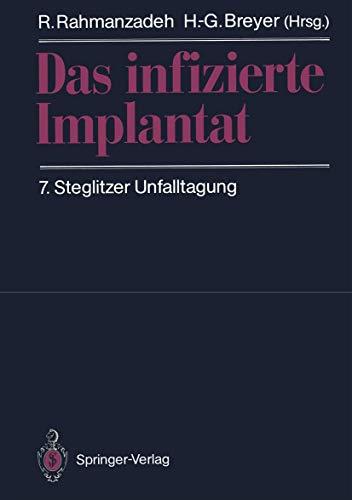 Beispielbild fr Das infizierte Implantat zum Verkauf von Chiron Media