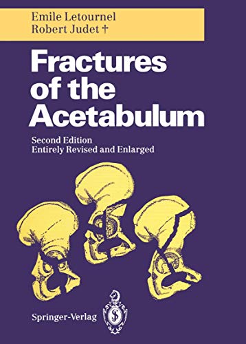 9783540521891: Fractures of the Acetabulum