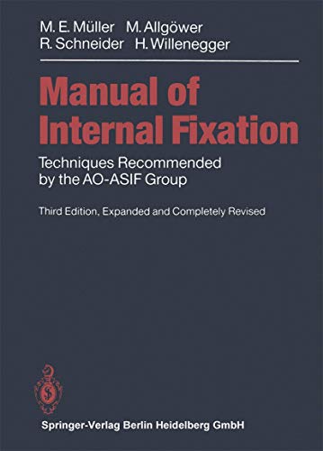Beispielbild fr Manual of INTERNAL FIXATION: Techniques Recommended by the AO-ASIF Group zum Verkauf von BooksRun