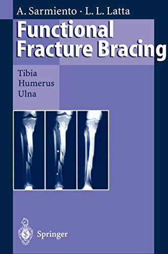 Stock image for Functional Fracture Bracing for sale by Books Puddle