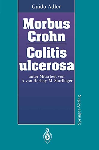 Beispielbild fr Morbus Crohn. Colitis ulcerosa zum Verkauf von Leserstrahl  (Preise inkl. MwSt.)