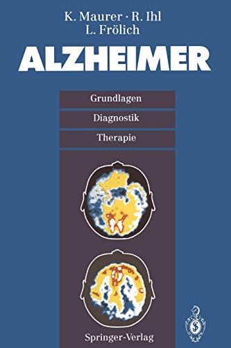 9783540569329: Alzheimer: Grundlagen, Diganostik, Therapie