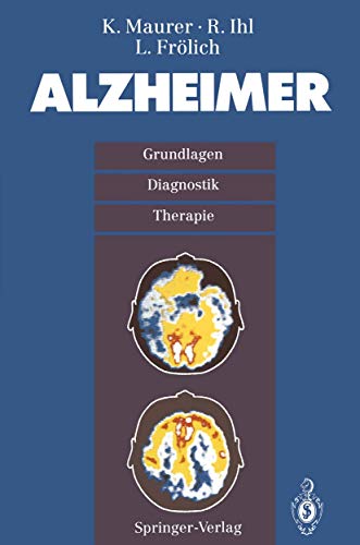 9783540569329: Alzheimer: Grundlagen, Diganostik, Therapie (German Edition)