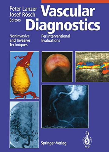 9783540579397: Vascular Diagnostics: Noninvasive and Invasive Techniques Periinterventional Evaluations