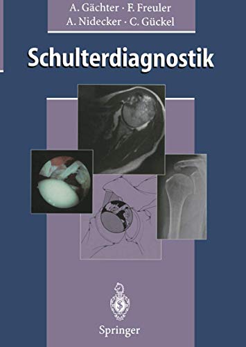 Stock image for Schulterdiagnostik for sale by medimops