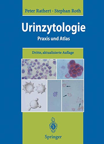 Imagen de archivo de Urinzytologie: Praxis und Atlas [Gebundene Ausgabe] Peter Rathert (Autor), Stephan Roth (Autor), A. Bcking (Assistent), R. Friedrichs (Assistent), F. Hofstdter (Assistent), J.-D. Hoppe (Assistent), E. Huland (Assistent), H. Huland (Assistent), R. Nafe (Assistent), T. Otto (Assistent), J.L. Papillo (Assistent), S. Peter (Assistent), P. Rttger (Assistent), H. Rbben (Assistent), B.J. Schmitz-Drger (Assistent) Geschichte der Urinzytologie, Indikationen zur Urinzytologie, Das nicht neoplastische bergangsepithel der ableitenden Harnwege, Epidemiologie, tiologie und Klassifikation des Harnblasenkarzinoms, Urotheliale Atypien und Dysplasien, Urinzytologisches Grading von Urotheltumoren, Urinzytologische Arbeitstechniken, Urinzytologischer Atlas, Urinmarker, Immunzytologie und weitere zellbasierte Nachweisverfahren beim Urotheltumor, Hmaturiediagnostik und Erythrozytenmorphologie Blasenkarzinom Blasenkrebs Blasentumordiagnostik Erythrozytenmorphologie Harn Harnorgane Harnuntersuchung Pa a la venta por BUCHSERVICE / ANTIQUARIAT Lars Lutzer