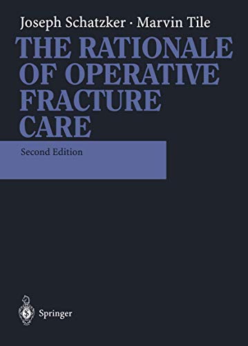Stock image for The Rationale of Operative Fracture Care for sale by HPB-Red