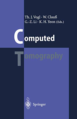 Imagen de archivo de Computed Tomography: State of the Art and Future Applications a la venta por Saint Georges English Bookshop