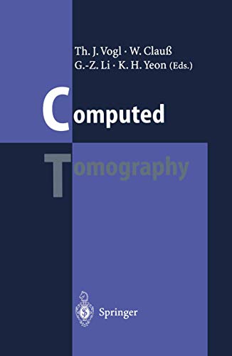 Stock image for Computed Tomography: State of the Art and Future Applications for sale by Saint Georges English Bookshop