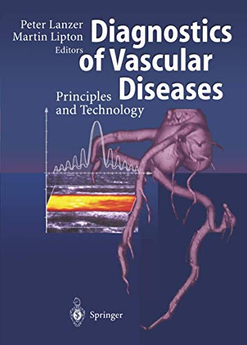 Stock image for Diagnostics of Vascular Diseases: Principles and Technology for sale by HPB-Red