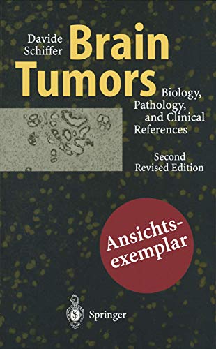 Beispielbild fr Brain Tumors: Biology, Pathology and Clinical References zum Verkauf von HPB-Red