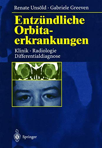 EntzÃ¼ndliche Orbitaerkrankungen: Klinik, Radiologie, Differentialdiagnose (German Edition) (9783540619260) by Renate UnsÃ¶ld; Gabriele Greeven