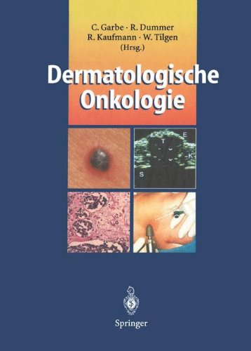 9783540619338: Dermatologische Onkologie