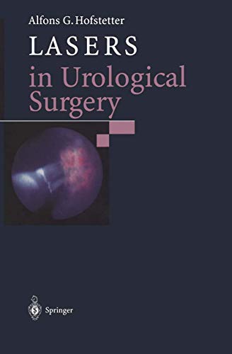 9783540624523: Lasers in Urological Surgery