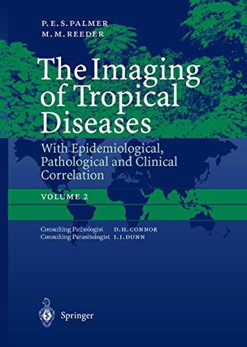 The Imaging of Tropical Diseases: With Epidemiological, Pathological and Clinical Correlation Volume 2 (9783540624714) by Philip E.S. Palmer