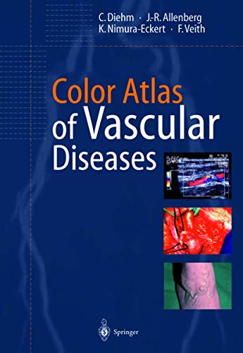 9783540626190: Color Atlas of Vascular Diseases