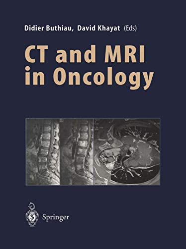 9783540627500: Ct and Mri in Oncology