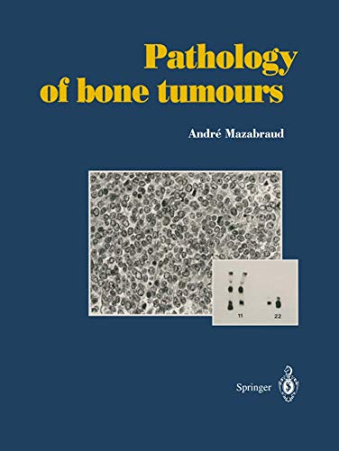 Beispielbild fr Pathology of bone tumours Personal experience zum Verkauf von Buchpark