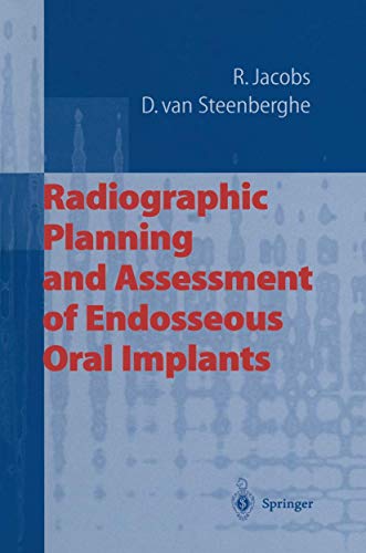 Stock image for Radiographic Planning and Assessment of Endosseous Oral Implants for sale by Mispah books