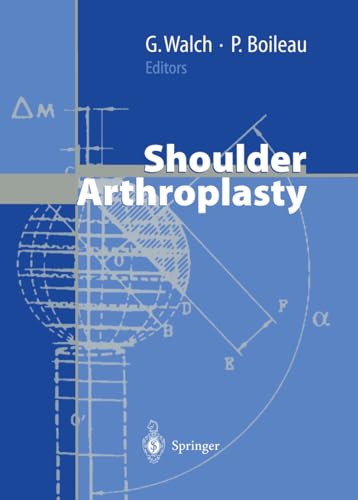 Stock image for Shoulder Arthroplasty for sale by medimops