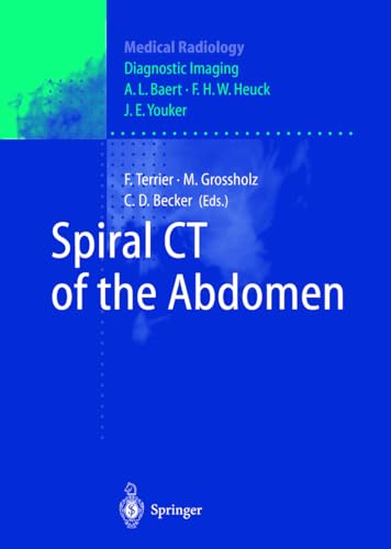 Beispielbild fr Spiral CT of the Abdomen. zum Verkauf von Gast & Hoyer GmbH