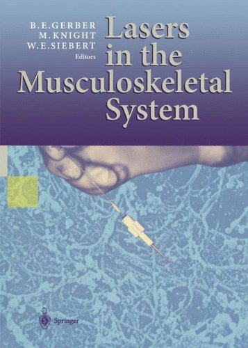 9783540637615: Lasers in the Musculoskeletal System
