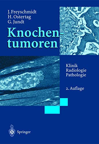 Knochentumoren Klinik - Radiologie - Pathologie - Freyschmidt, Jürgen, Helmut Ostertag und Gernot Jundt