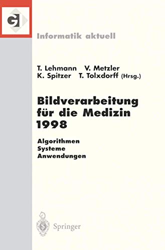 Stock image for Bildverarbeitung Fur Die Medizin 1998: Algorithmen Systeme Anwendungen Proceedings Des Workshops Am 26. Und 27. Marz 1998 in Aachen for sale by Chiron Media