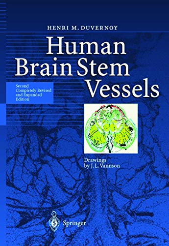 Beispielbild fr Human Brain Stem Vessels zum Verkauf von Books Puddle