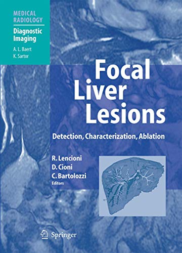 9783540644644: Focal Liver Lesions: Detection, Characterization, Ablation (Medical Radiology)