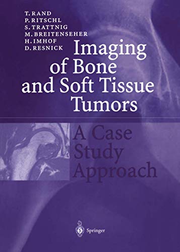 Imaging of Bone and Soft Tissue Tumors: A Case Study Approach (9783540650966) by Rand, T.