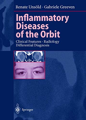 Inflammatory Diseases of the Orbit: Clinical Features, Radiology, Differential Diagnosis (9783540650980) by UNSOLD