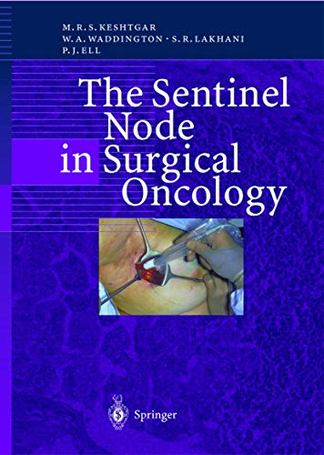 Stock image for The Sentinel Node in Surgical Oncology for sale by Better World Books: West