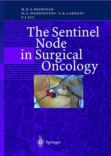 9783540651765: The Sentinel Node in Surgical Oncology