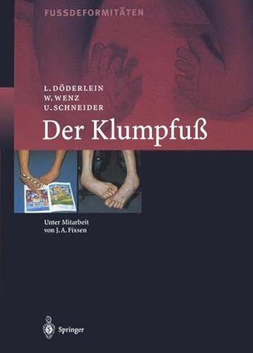 Beispielbild fr Der Klumpfuss: Erscheinungsformen und Behandlungsprinzipien jeden Alters. Differentialdiagnose und Differentialtherapie [Gebundene Ausgabe] Fudeformitten Klumpfu Fussdeformitten Diagnostik Operationstechniken Therapie Behandlung Leonhard Dderlein Wolfram Wenz Urs Schneider J.A. Fixsen Der Klumpfuss Der Klumpfu [HARDCOVER] zum Verkauf von BUCHSERVICE / ANTIQUARIAT Lars Lutzer