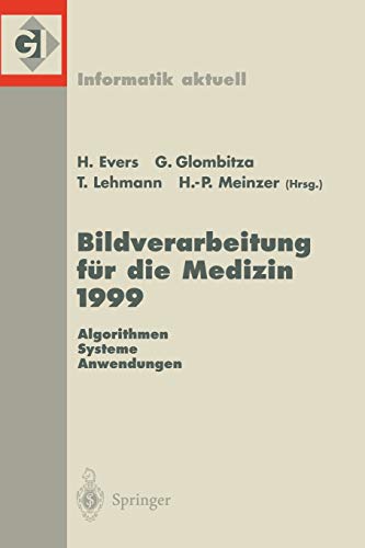 9783540656272: Bildverarbeitung fr die Medizin 1999: Algorithmen ― Systeme ― Anwendungen Proceedings des Workshops am 4. und 5. Mrz 1999 in Heidelberg (Informatik aktuell)