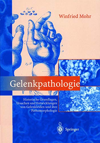 Stock image for Gelenkpathologie [Gebundene Ausgabe] von Winfried Mohr (Autor), Rosa Endres-Klein for sale by BUCHSERVICE / ANTIQUARIAT Lars Lutzer