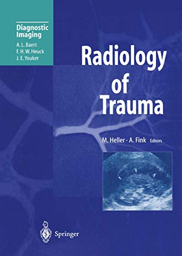 Stock image for Radiology of Trauma (Medical Radiology / Radiation Oncology) for sale by medimops