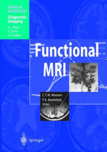 9783540672159: Functional MRI (Medical Radiology)