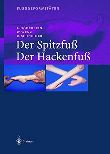 9783540674412: Fussdeformitaten: Der Spitzfu / Der Hackenfu