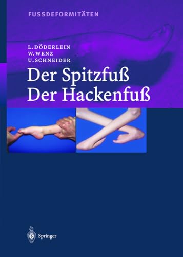 9783540674412: Fussdeformitten: Der Spitzfu / Der Hackenfu (German Edition)