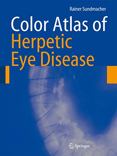 9783540694625: Color Atlas of Herpetic Eye Disease: A Practical Guide to Clinical Management