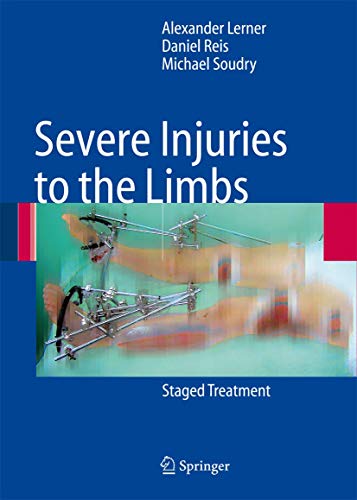 Beispielbild fr Severe Injuries to the Limbs Staged Treatment zum Verkauf von Buchpark