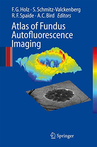 Stock image for Atlas of Fundus Autofluorescence Imaging for sale by Phatpocket Limited