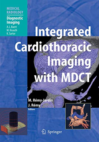 Integrated Cardiothoracic Imaging with MDCT. With contributions by numerous experts.