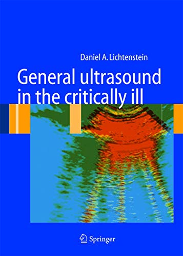 Beispielbild fr General Ultrasound in the Critically Ill zum Verkauf von Revaluation Books