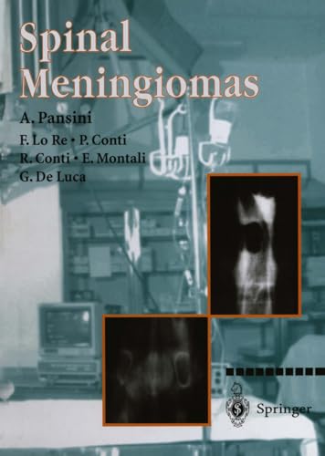 Spinal Meningiomas.