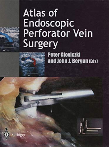 9783540761716: Atlas of Endoscopic Perforator Vein Surgery