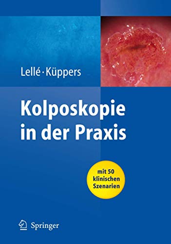 Kolposkopie in der Praxis: mit 50 klinischen Szenarien - Lellé, Ralph J.; Küppers, Volkmar