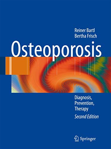 9783540795261: Osteoporosis: Diagnosis, Prevention, Therapy